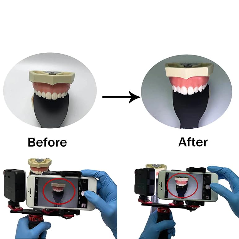 Impressive Smile Dental Photography Aid, Oral Cell Phone Camera Fill Light Brightness Led Video Light Studio Lighting Kit For Ho