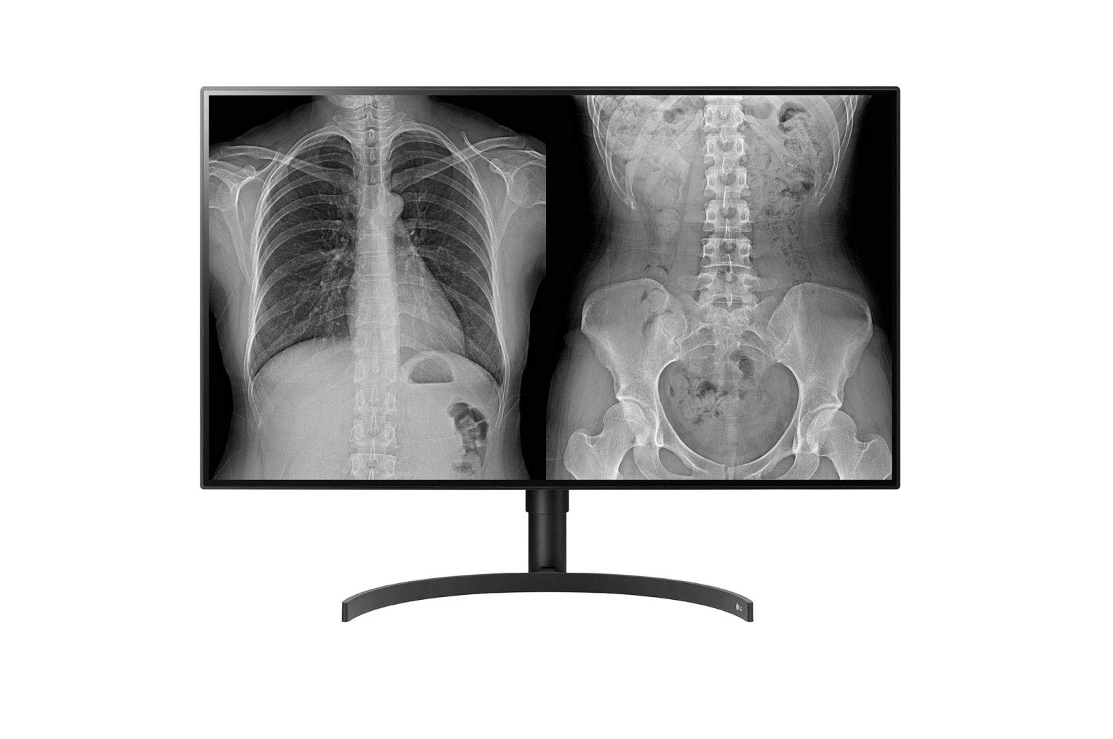 Lg 32Hl512D-B - Lcd Monitor - Flat - 3840 X 2160 - 31.5Inch - 5Ms Response Time