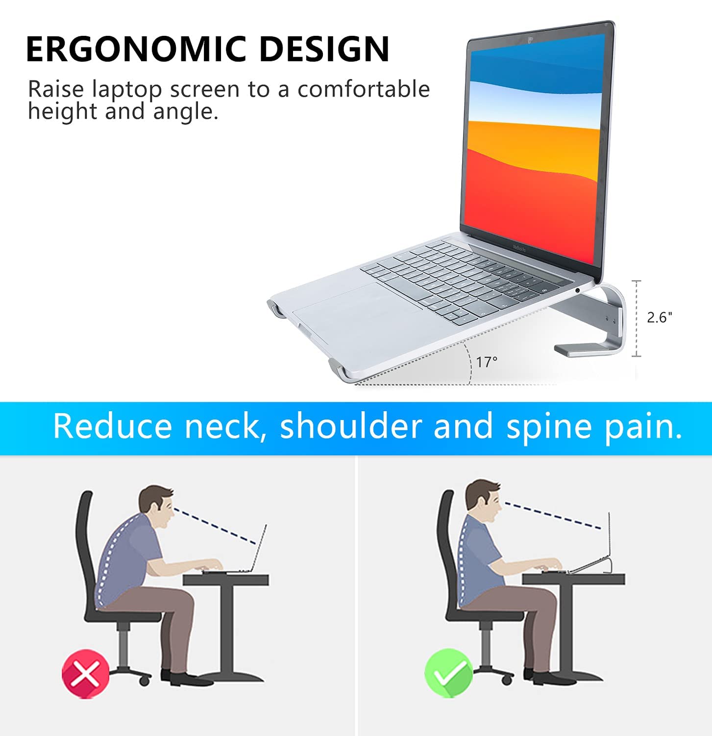 Kyqee Laptop Riser For Desk, Laptop Stand, Ergonomic Aluminum Computer Stand For Laptop, Ventilated Notebook Stand Compatible Wi