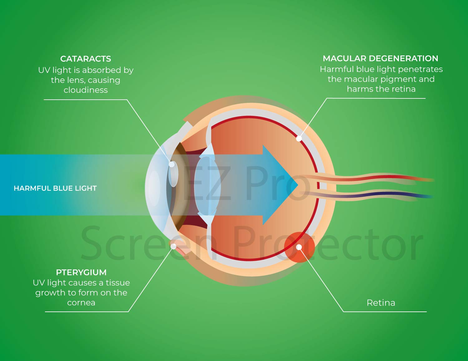 Anti Blue Light Screen Filter For 23 Inches Widescreen Desktop Monitor, Blocks Excessive Harmful Blue Light, Reduce Eye Fatigue