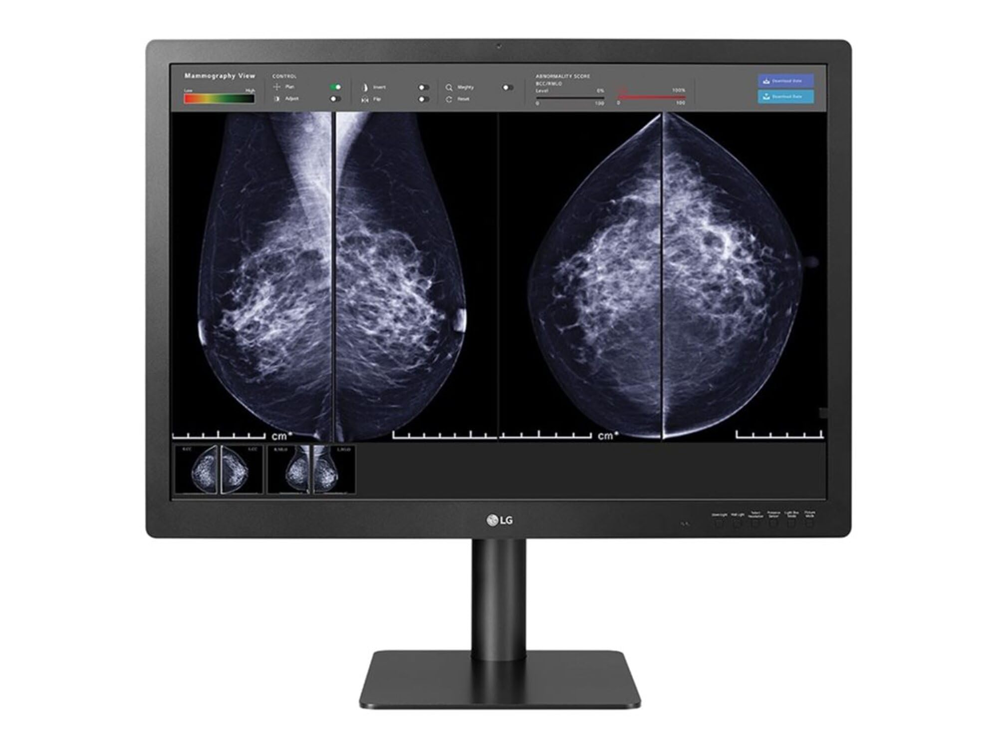 31In Lg Medical Anti-Glare, 3H Dignostic Monitor 4200 X 2800 (3:2) Class Ii Fda
