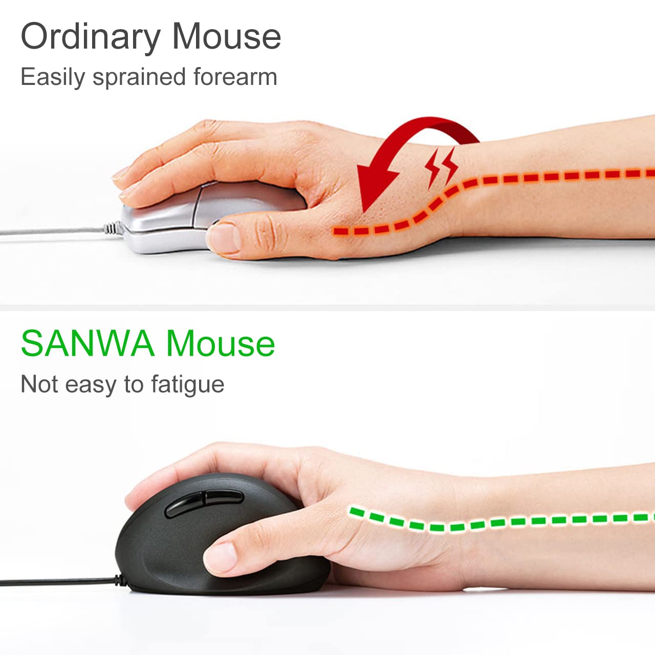 Sanwa Wired Ergonomic Mouse, Optical Vertical Mice, For Small Hands, Reduce Wrist Strain, 1000/1600 Dpi, 6 Buttons, Compatible W