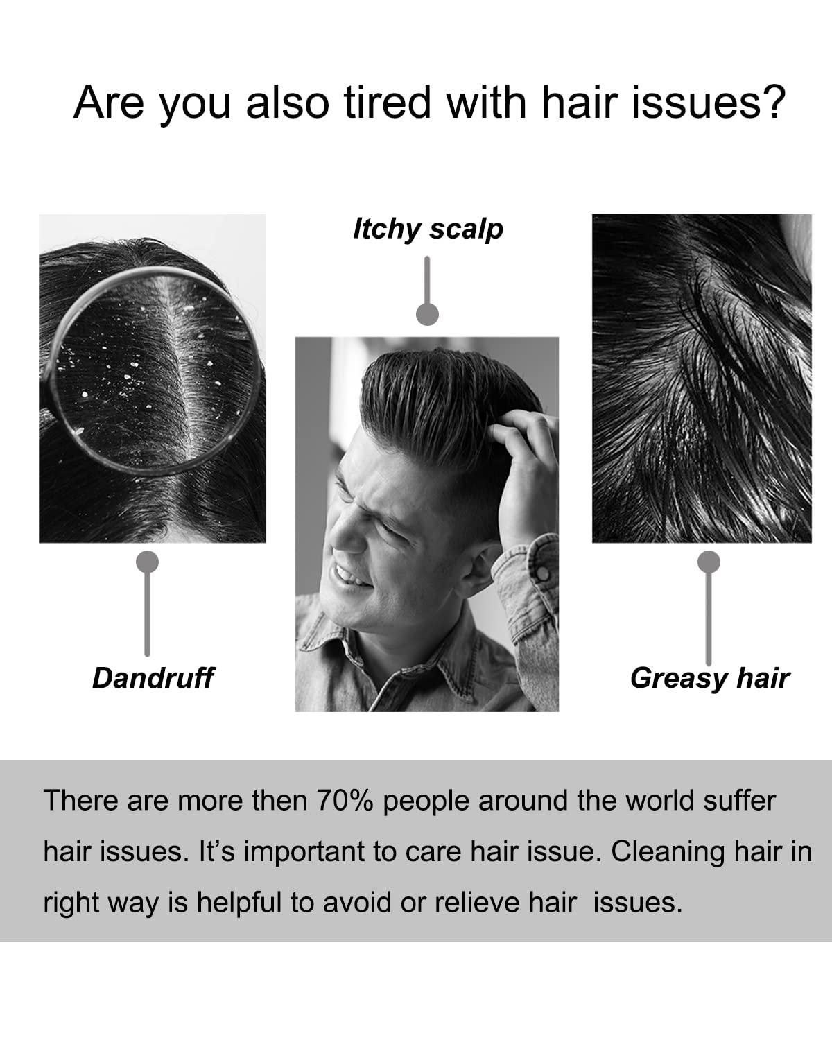 Winyoung Scalp Massager, Electric Scalp Massage Brush, Hair Massage Brush, Electric Head Scratcher, Massage Comb With Soft Rubbe