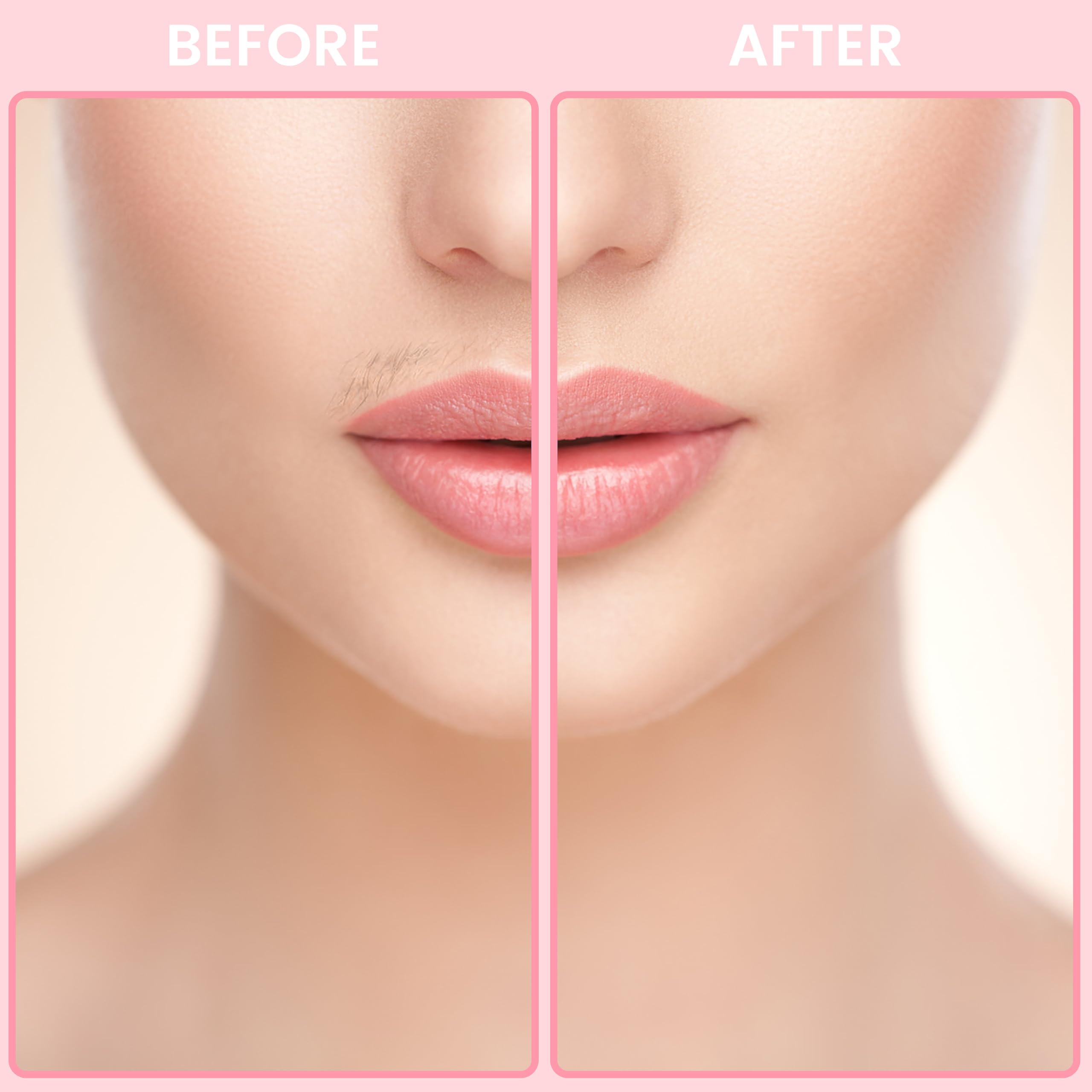 Sweetlf Portable Electric Shaver For Women, Ipx7 Waterproof, Painless, Rechargeable, Wet & Dry Shaving, Face & Chin & Upper Lip,