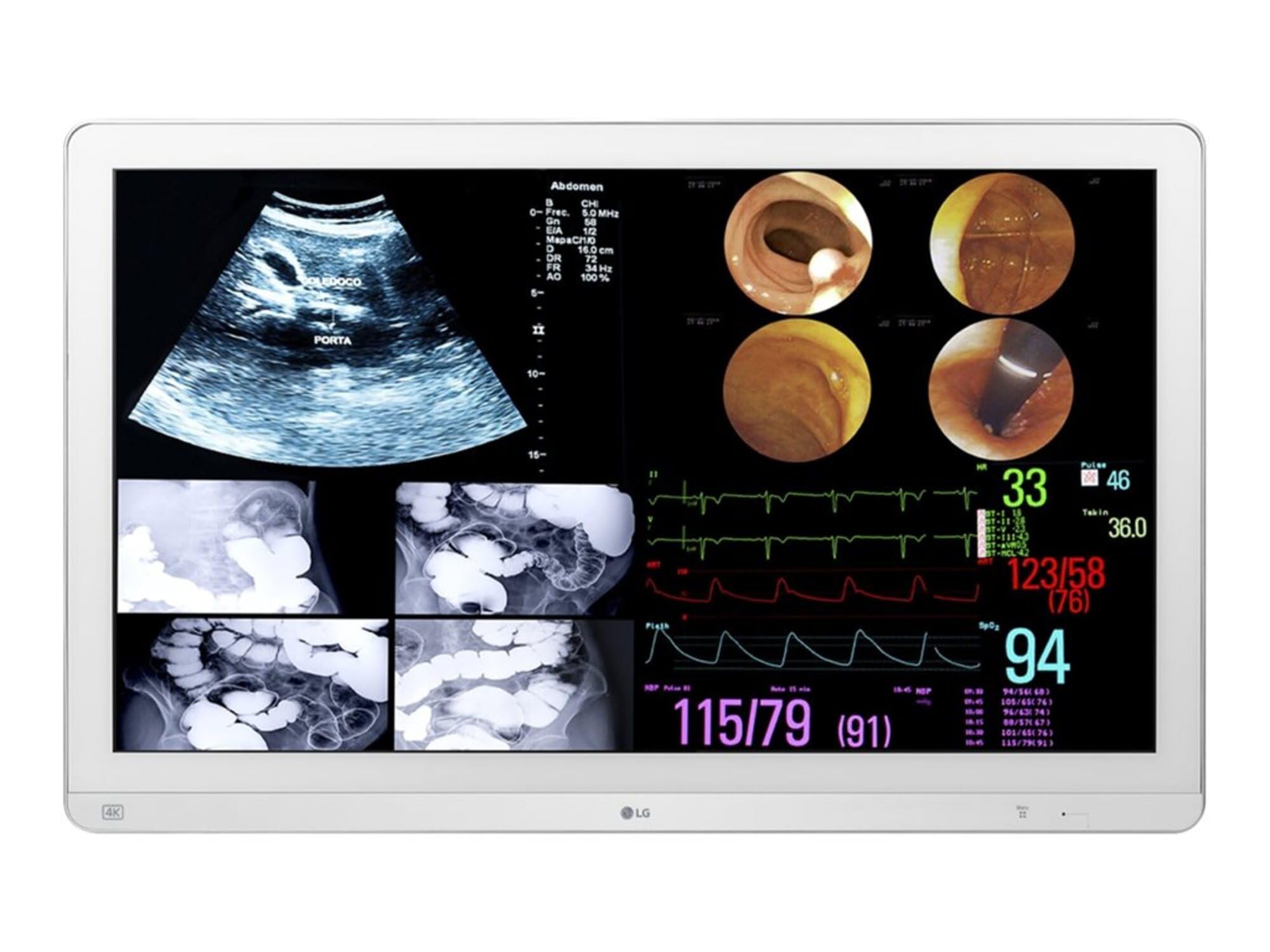 32Inch Lg Medical Ips 4K Surgical Monitor, 3480X2160, Hdmi Dp Usb, Hdr10 Dicom H
