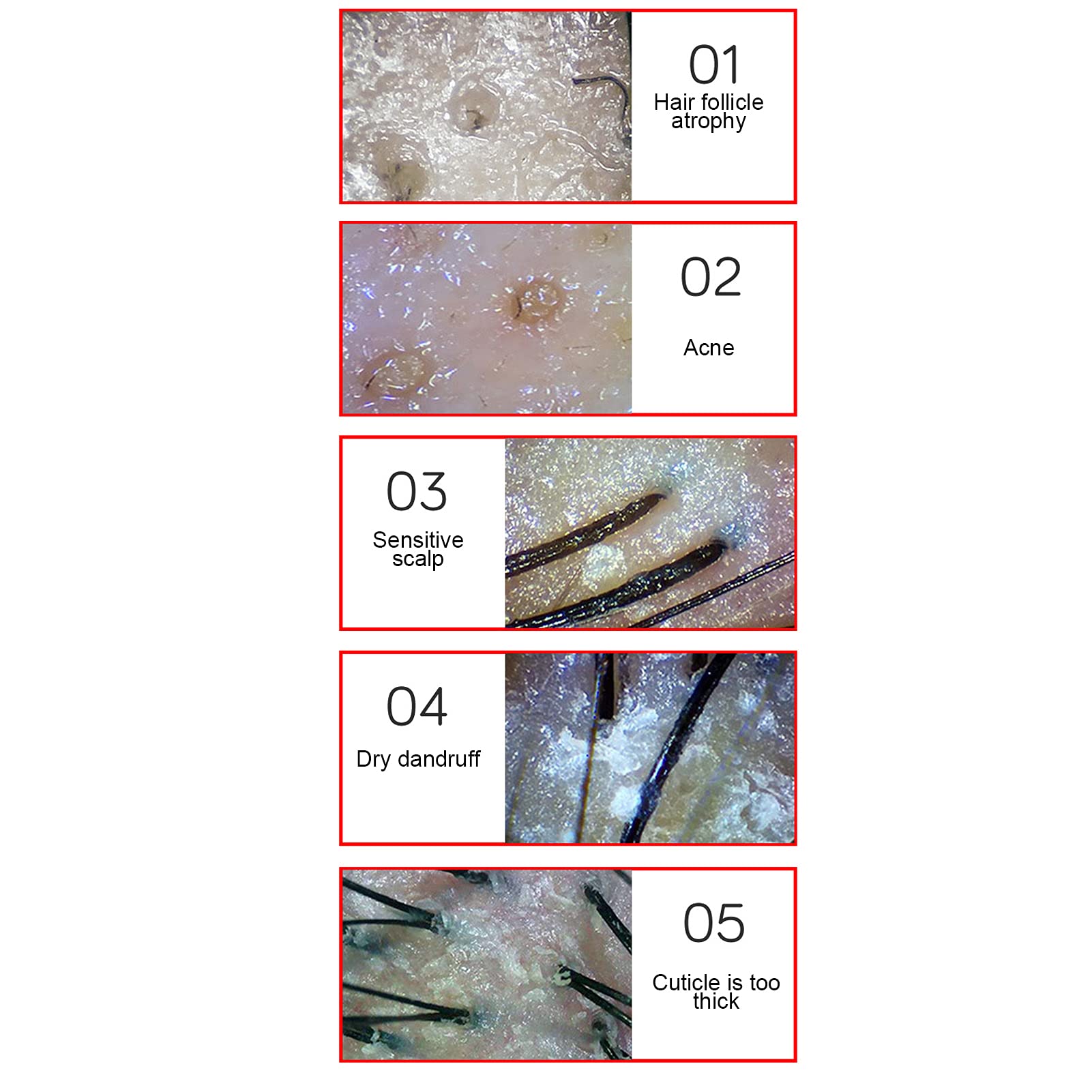 Scalp Detector, 13Inch 50X/200X Lens Multi Functional Rechargeable Digital Hair Skin Analyzer Microscope Magnifier High Sensitiv