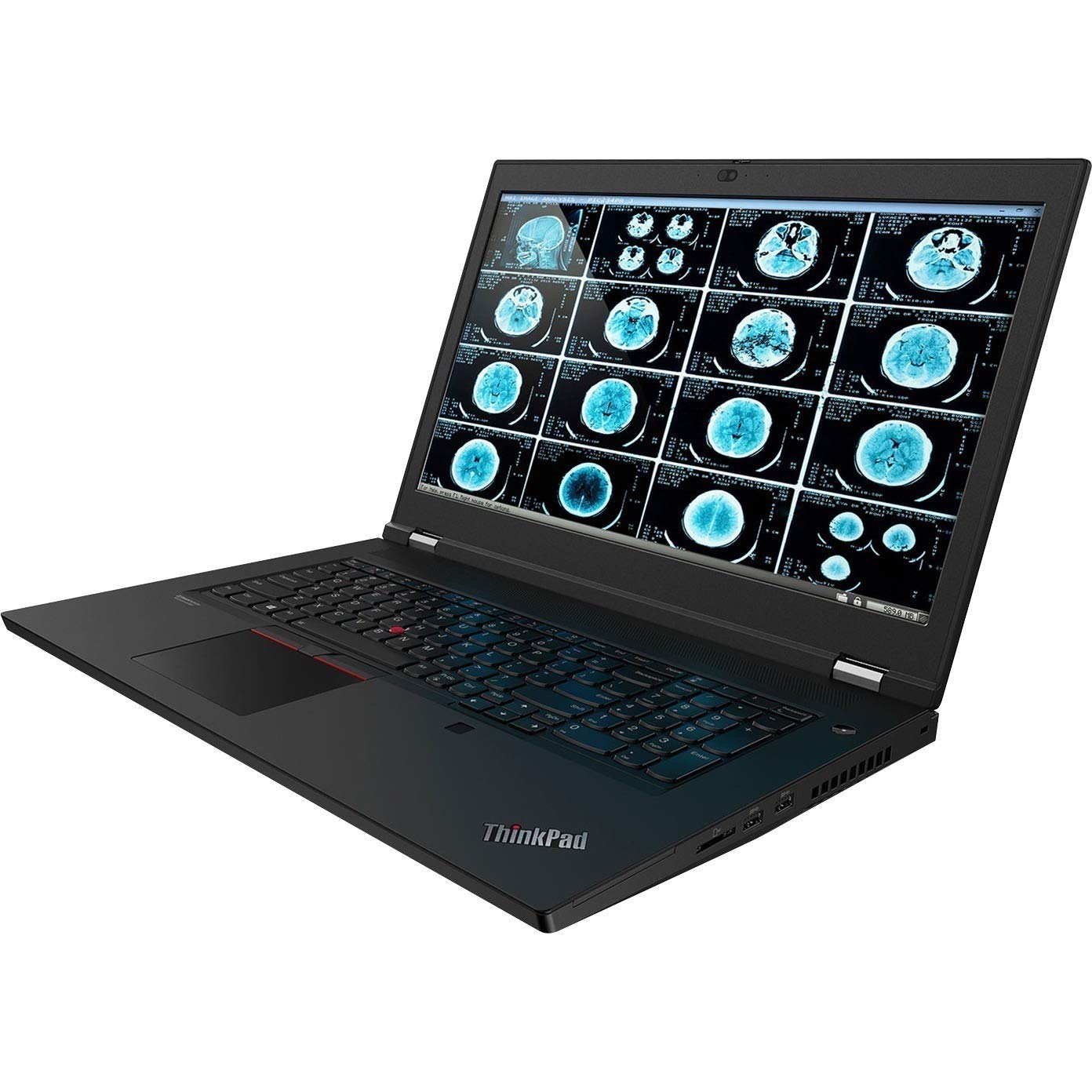 Lenovo Thinkpad P17 Gen 1 20Sn003Yus 17.3 Mobile Workstation - Full Hd - 1920 X 1080 - Intel Core I7 (10Th Gen) I7-10750H Hexa-C