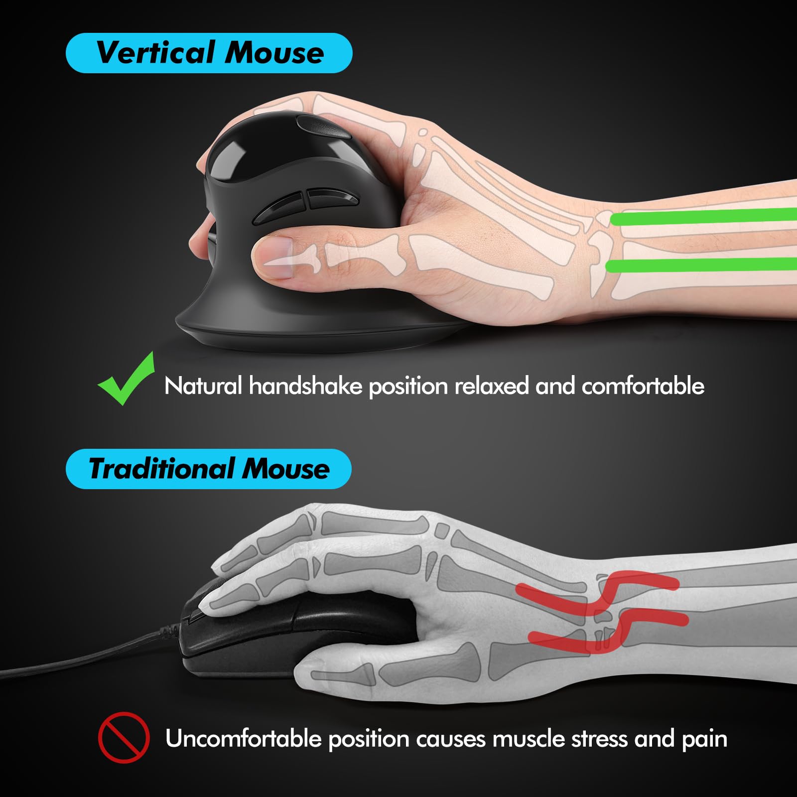 Micropack Ergonomic Mouse, Vertical Wireless Mouse With Usb A & Type C Receiver, Ergo Design Reduces Muscle Strain, 6 Buttons 80