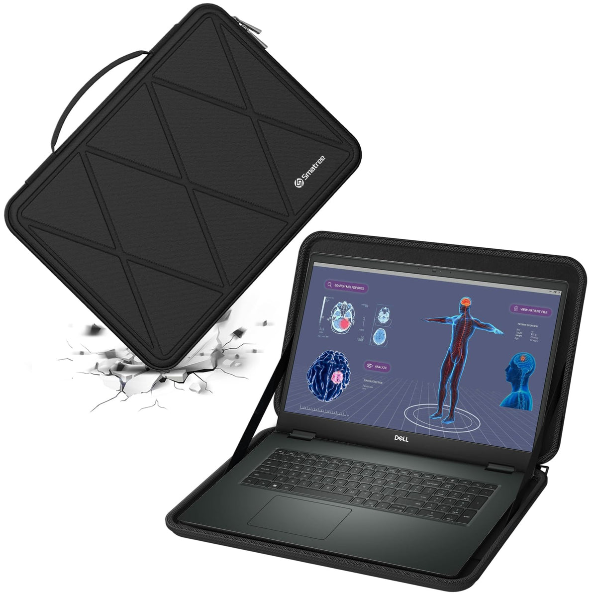 Smatree Hard EVA Protective Sleeve Case Compatible for 17.3 inch DELL Precision 7780 Workstation/Precision 7770 Workstation (X8325)