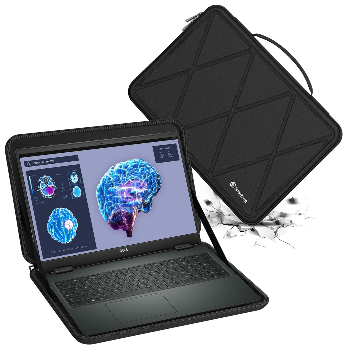 Smatree Hard EVA Protective Sleeve Case Compatible for 16 inch DELL Precision 7680/7670 Workstation Laptop, for DELL Precision Workstation Laptop Slim and Anti-Shock Case Notebook Bag (X8287)