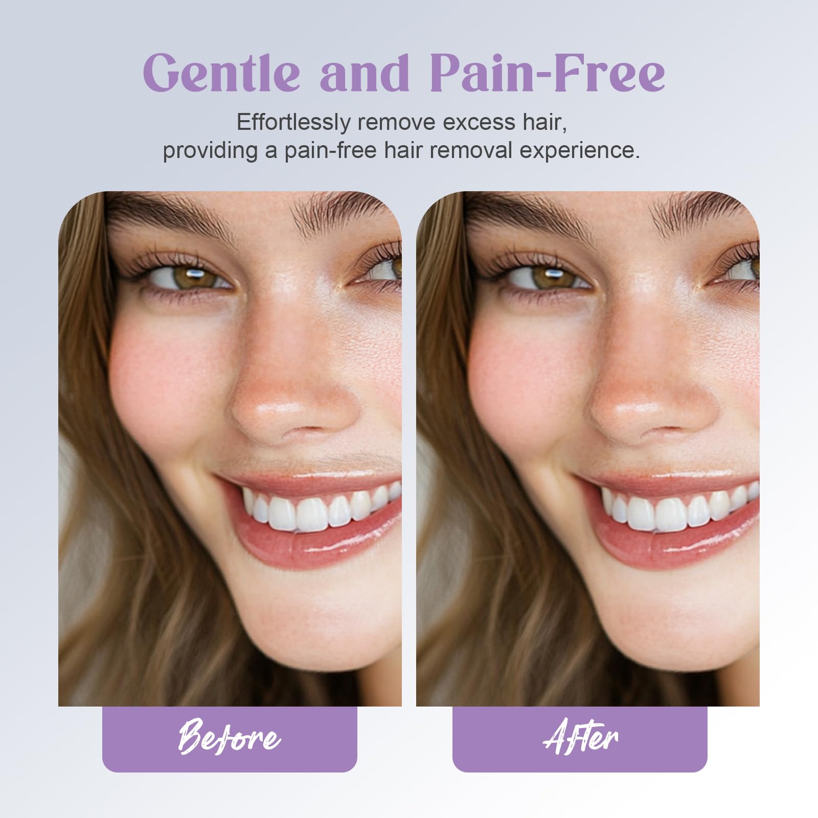 Battery Powered Facial Hair Remover For Women Lips, Chin, Neck, And Cheeks   Gentle And Pain With 2 Pc Replacement Heads (Batter