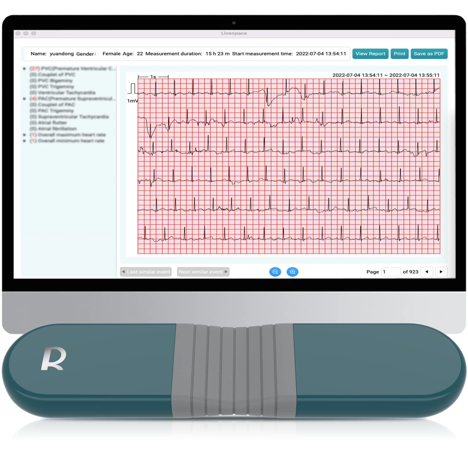 Livenpace Ai Hr Monitor, 24 Hours Chest Lead Device With Free Ai Analysis & Pc Report, Chargeable Recorder, Hhm1