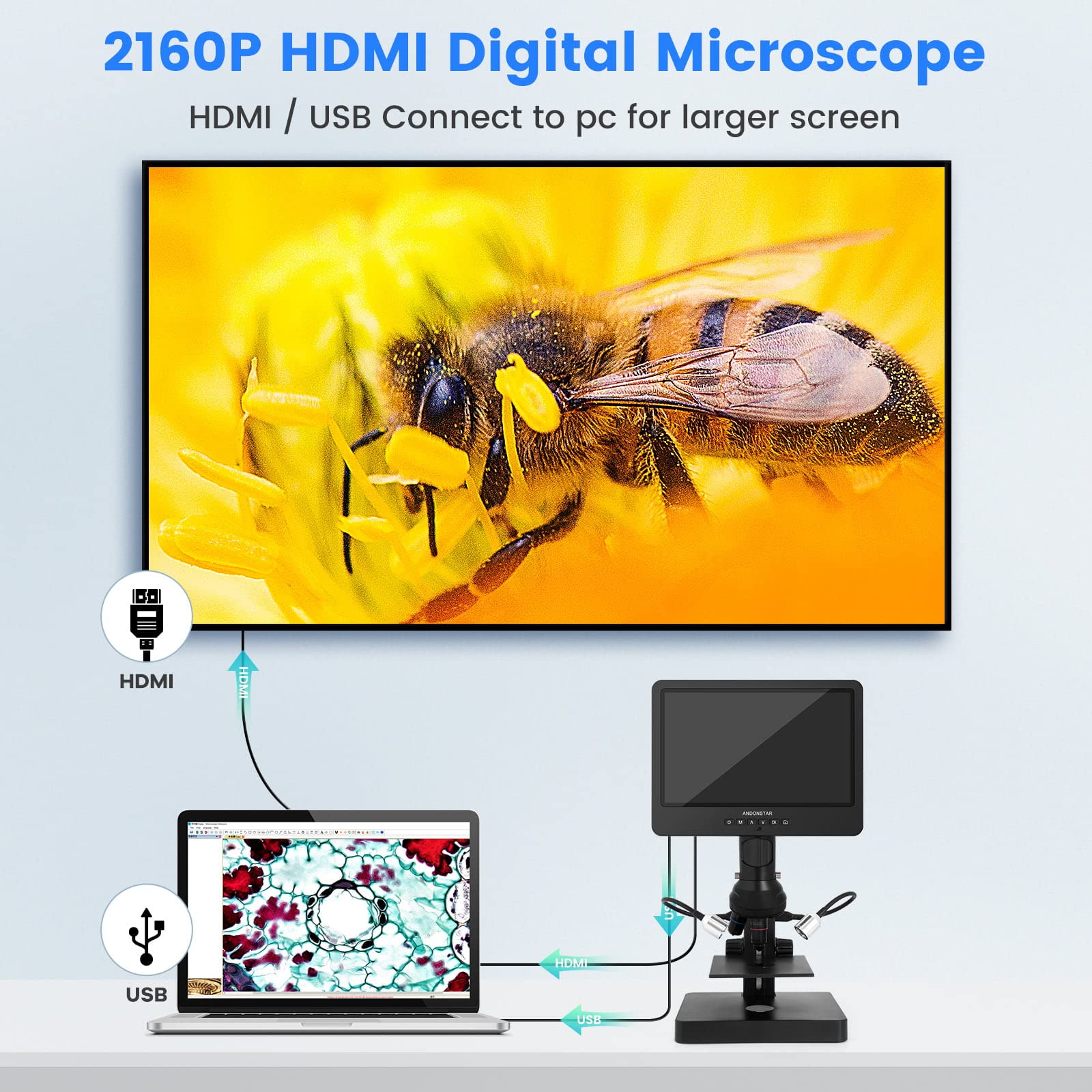 Andonstar Ad249Sp Uhd 2160P Hdmi Digital Microscope 4000X, 3 Lens 10.1 Inch Lcd For Biological Microscope Kit, Pcb Soldering Mic