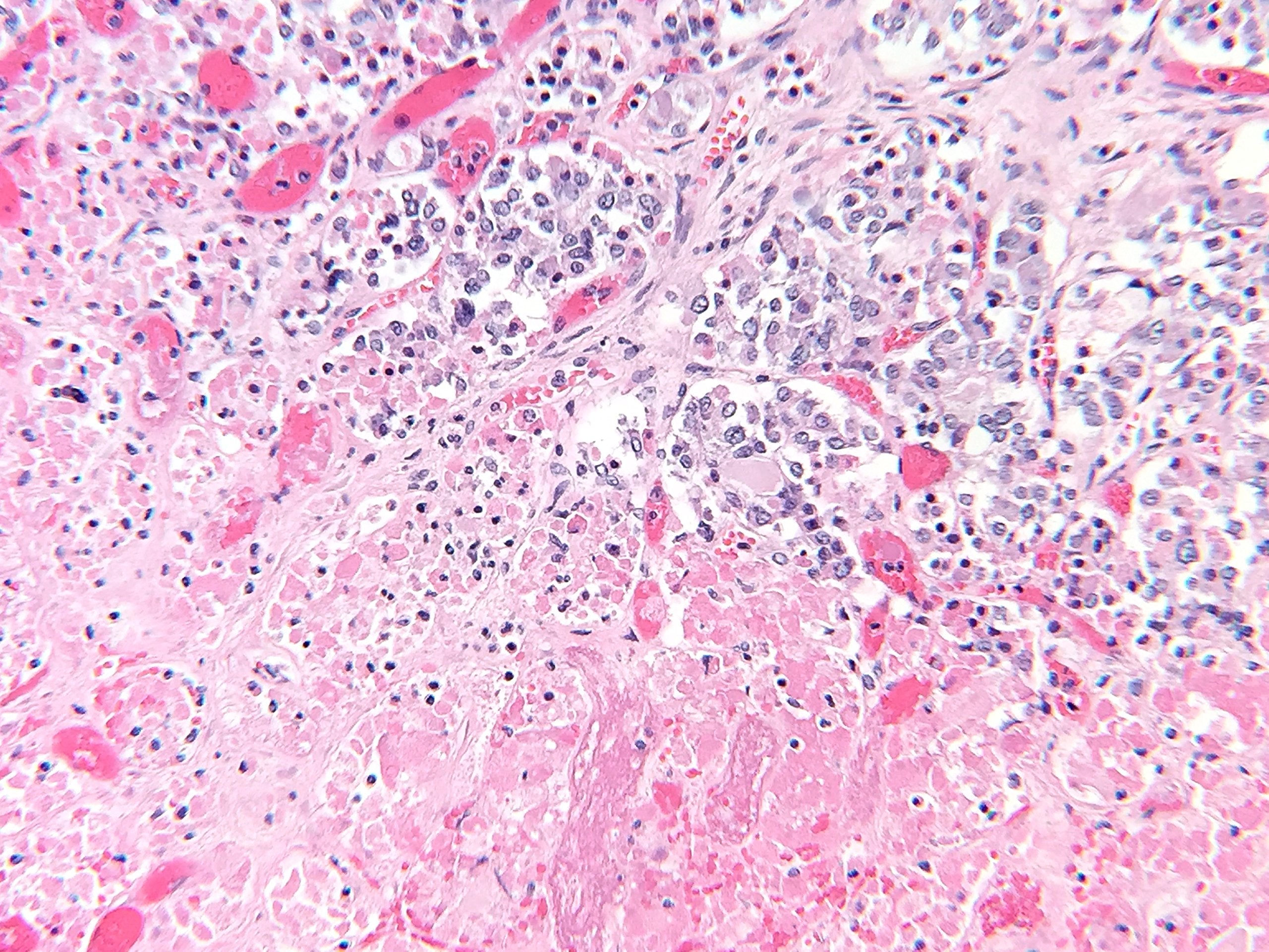 Labcam Microscope Adapter For Iphone 6/6S