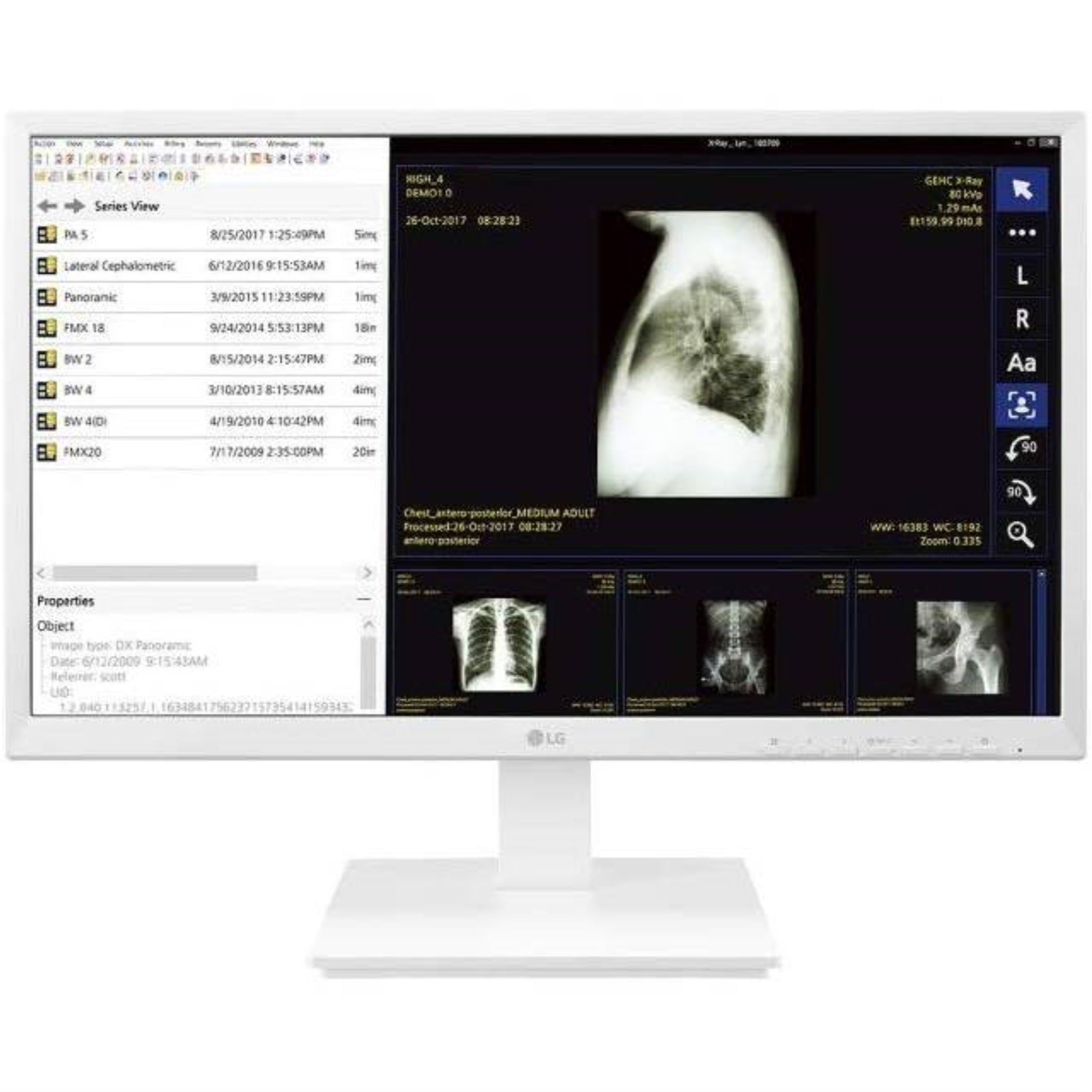 Lg Thin Client 24Ck560N 3A 24.0 Inch Amd Pairie Falcon Gx 212Jj/ 4Gb Ddr4/ 32Gb Ssd/ Non Os All In One Pc (White)